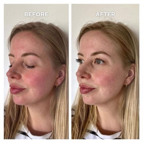 Skin Care Snelle Huiddetox Met Peeling Witlof Skincare